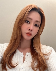 절개눈매교정 재수술, 앞트임 후기