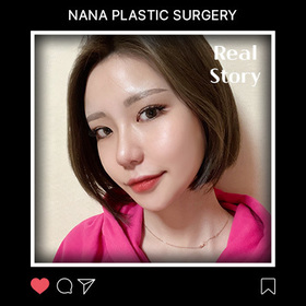 광대, 사각턱, 비절개눈매교정, 가슴, 부유방지흡 후기