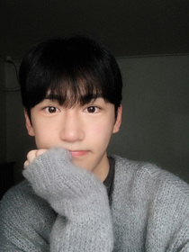 광대, 절개, 눈밑지방재배치 후기