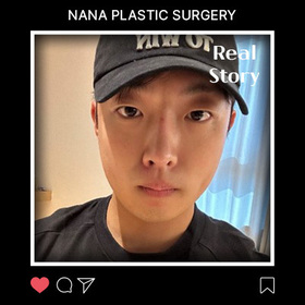 윤곽 3종 , 코 후기