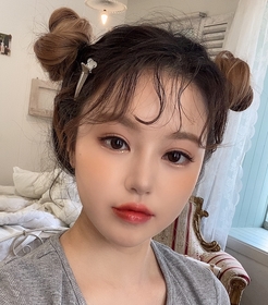비절개눈매교정 후기