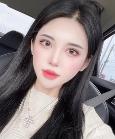 비절개 눈매교정(재수술), 윗트임, 밑트임 후기