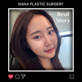 윤곽3종,얼굴전체흡입 후기
