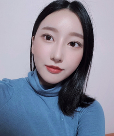 절개 눈매교정 재수술, 밑트임 후기