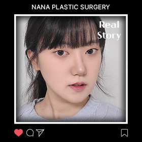 긴곡선 사각턱 후기