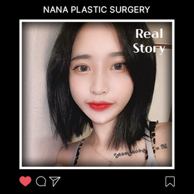윤곽3종, 가슴, 눈, 코 후기