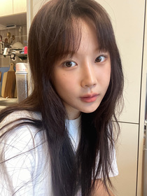 비절개눈매교정, 앞트임 후기