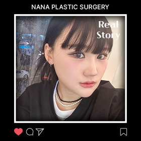 윤곽,눈 3종,절개 후기