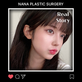 안면윤곽 후기