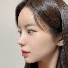 코끝, 콧대, 절골, 매부리, 휜코 후기