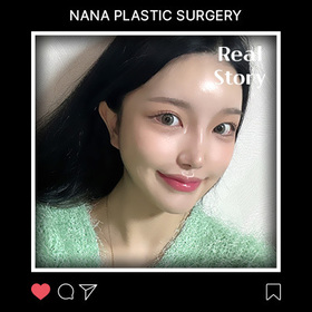 윤곽3종, 코, 얼굴지방흡입 후기