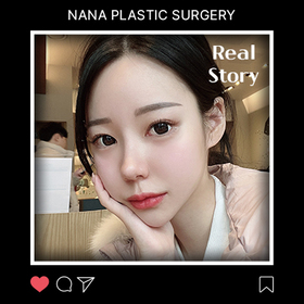 윤곽, 코, 지방이식 후기