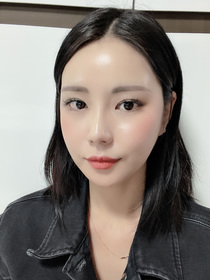 비절개눈매교정 후기