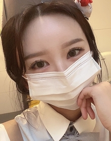 절개쌍꺼풀(재수술), 앞트임 후기
