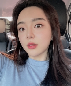 눈밑지방재배치 후기