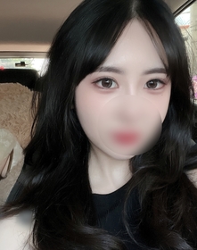 절개쌍꺼풀 앞트임 후기