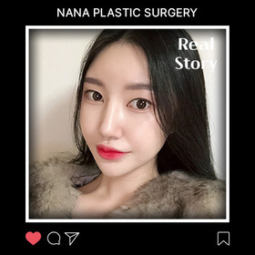 윤곽3종, 눈, 코 후기