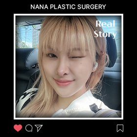 윤곽, 코, 가슴 후기
