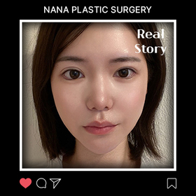 윤곽3종 후기