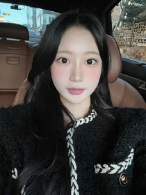 매몰쌍꺼풀, 비절개 눈매교정 후기