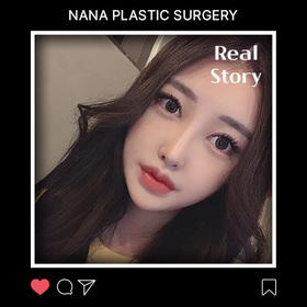 광대, 사각턱, 앞턱, 코 후기