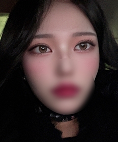 절개쌍꺼풀 앞트임 후기