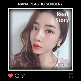 광대, 눈, 코 후기