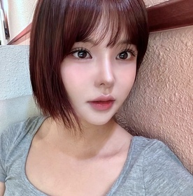 절개눈매교정,앞트임,뒤트임,밑트임 재수술 후기