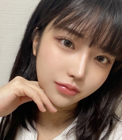 절개눈매교정 재수술 후기