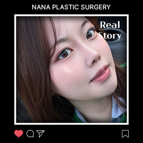 윤곽3종, 코 후기