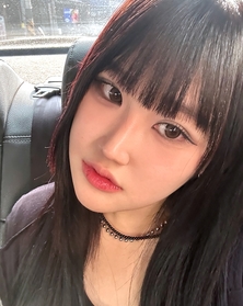 절개쌍꺼풀 재수술, 앞트임 후기
