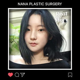 안면윤곽3종 후기