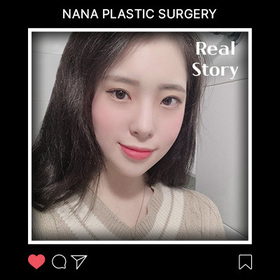 윤곽, 이식 후기