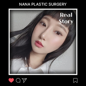 광대, 사각턱, 코, 가슴, 절개눈매교정재수술, 밑트임, 지방이식 후기