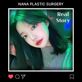 윤곽2종, 앞트임, 코 후기