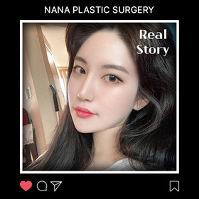 윤곽3종 이마거상 코 앞트임 후기