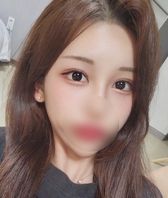 매몰쌍꺼풀(재수술),밑트임 후기