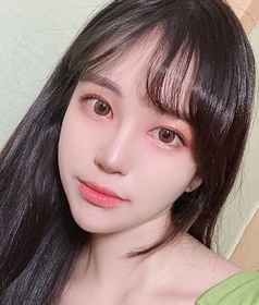 앞트임 후기