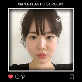 윤곽 3종, 매몰, 듀얼트임 후기
