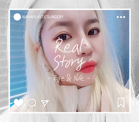 눈,코성형 후기