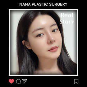 매몰재수술, 광대, 사각턱, 코, 얼굴지방흡입 후기