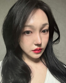 눈밑지방재배치 후기