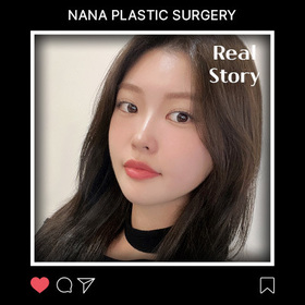 윤곽3종, 지방이식 후기