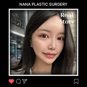 윤곽,코.,지방흡입 후기