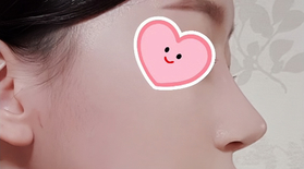 빼꼼이's Nose review
