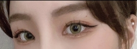 itxufx's Upper Canthoplasty, Lower Canthoplasty review