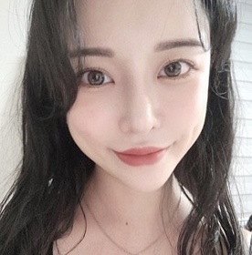 수피앙's Eyes, Fat Grafting review