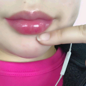 불리블리꺄악's Lip Filler review