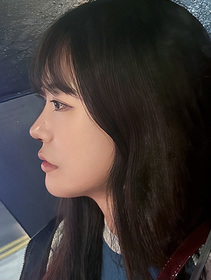 쩡쩡이's Nasal Bridge, Nasal Tip, Dorsal Hump, Short Nose review