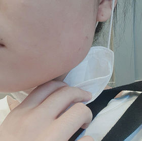 seoul's Jaw Botox review